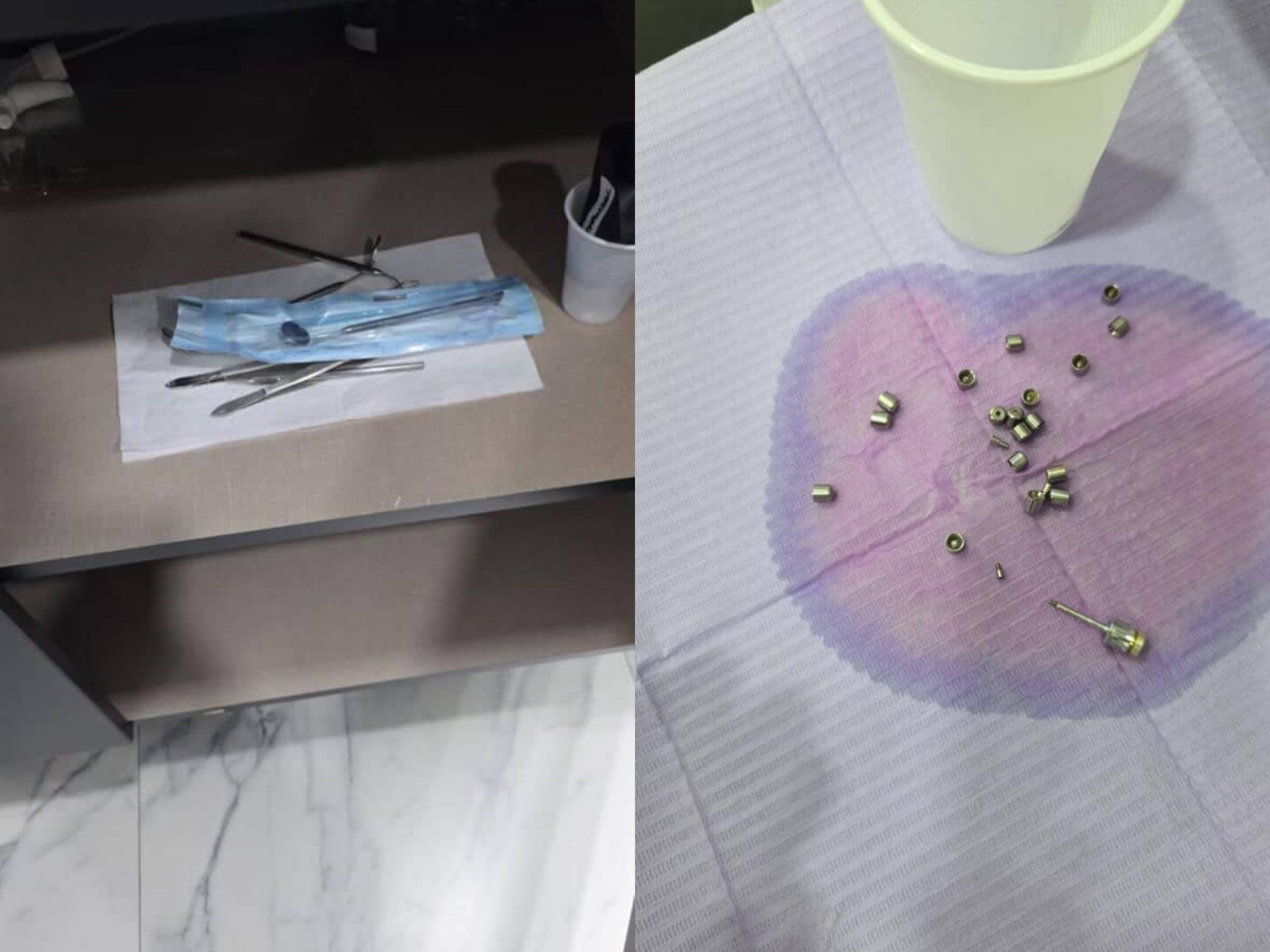  Pa siguracione dhe pa higjienë   Ish punonjësja denoncon klinikën dentare në Tiranë