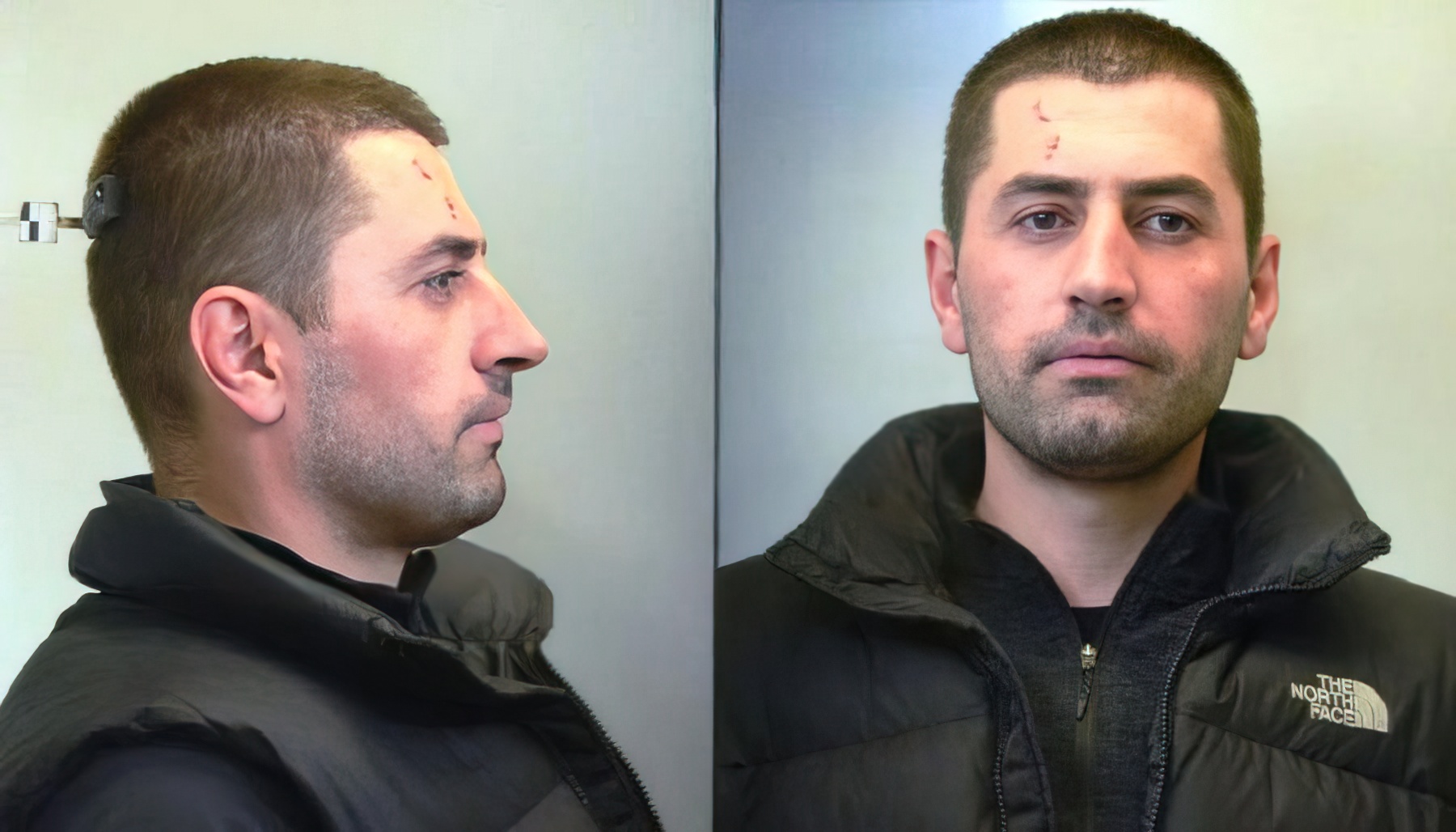 Titi u plagos pas përplasjes me armë me policinë  në çantë i gjenden granata dhe municione