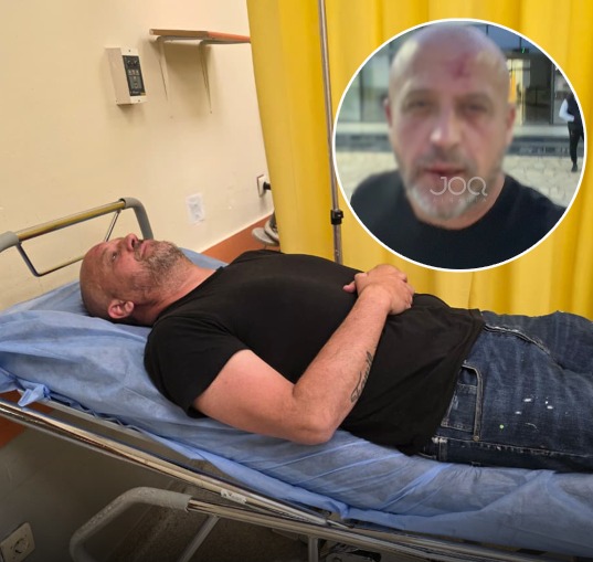 Dhunimi i gazetarit shkodran  reagon policia  Dushi  Tentuan të më shtypnin me makinë para se të më telefononte Prek Gjoni 