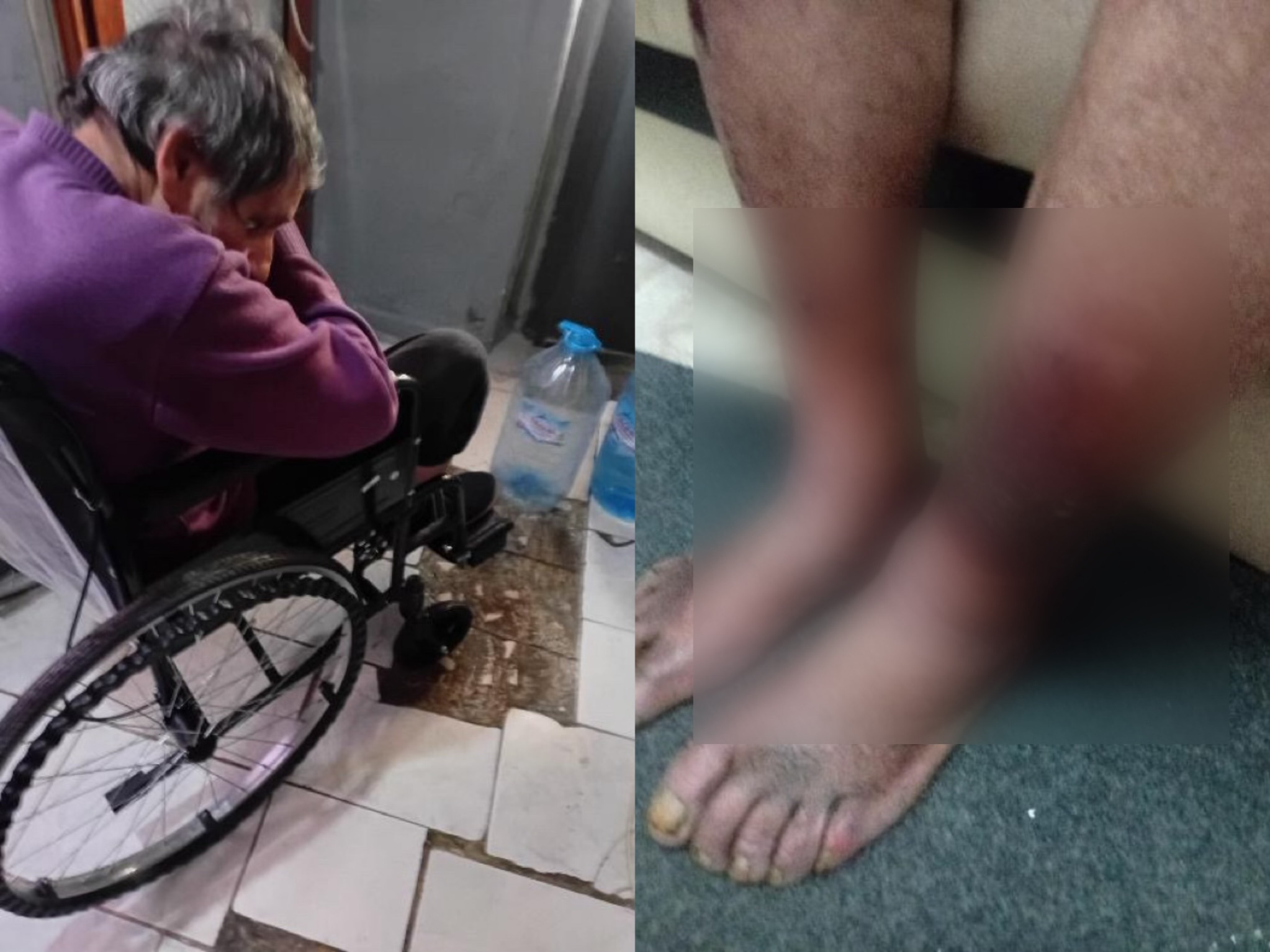 Çifti nga Shijaku kërkon ndihmë  Zonja e verbër  burri me diabet dhe i paralizuar
