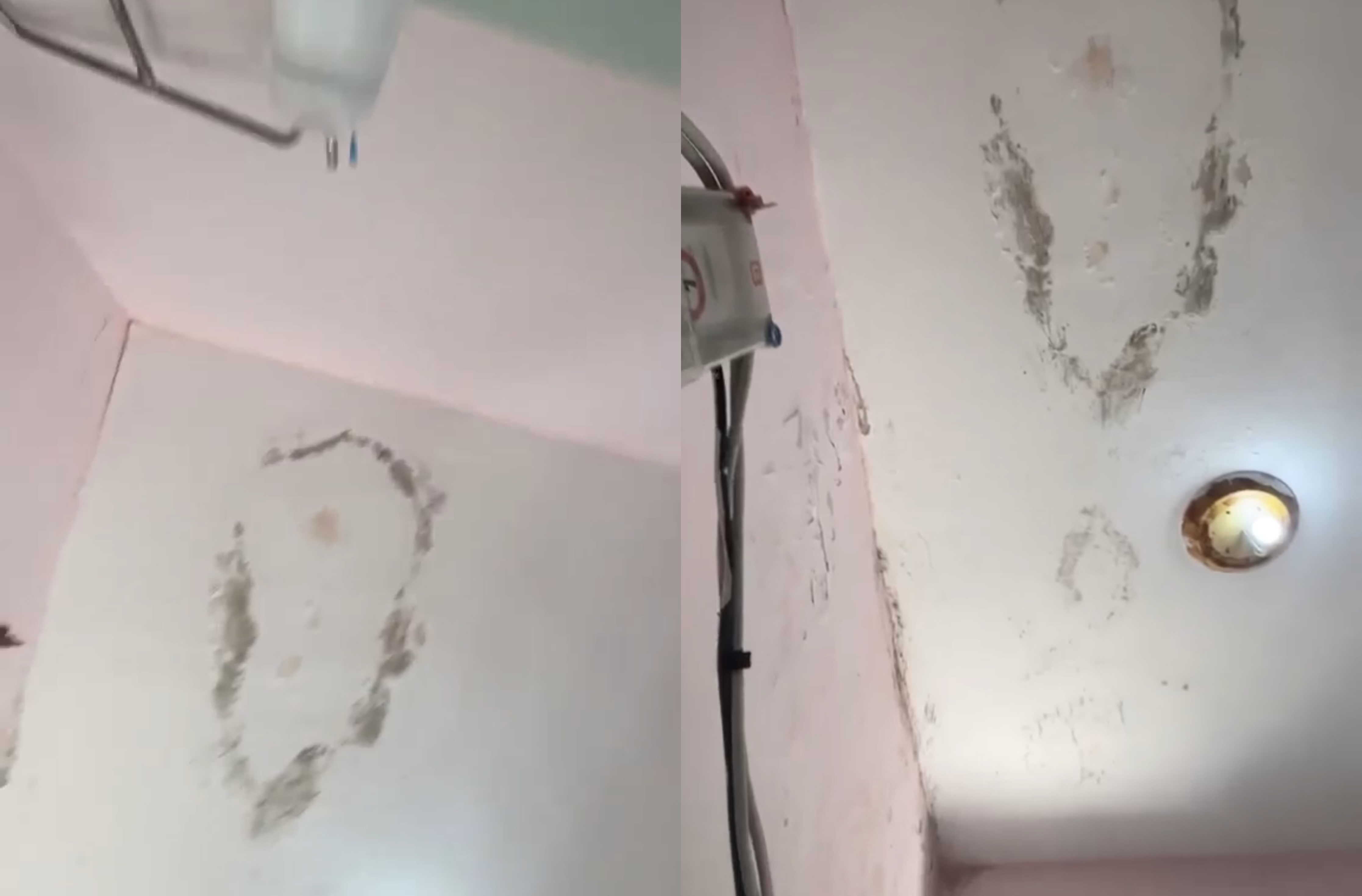 Qendrës Shëndetësore te  Treshi  i ka rënë suvaja  muret plot me lagështirë