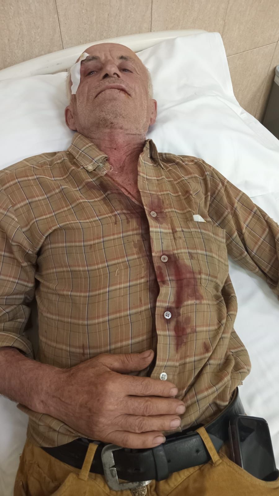 Del fotoja e të moshuarit që u bë për spital nga kunati i Luiz Ejllit