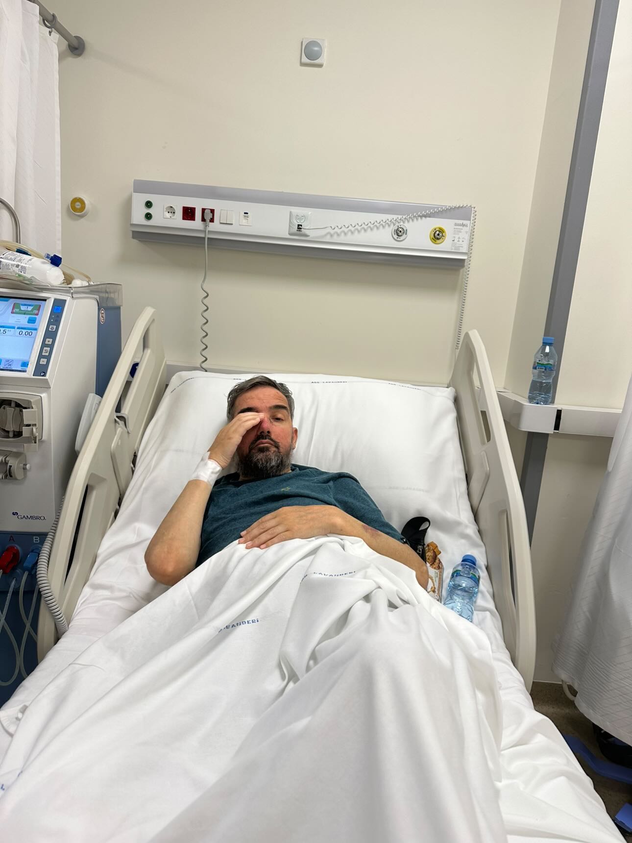 Motra do i dhurojë veshkën  babai i dy vajzave të vogla ka nevojë për ndihmë për të kryer transplantin