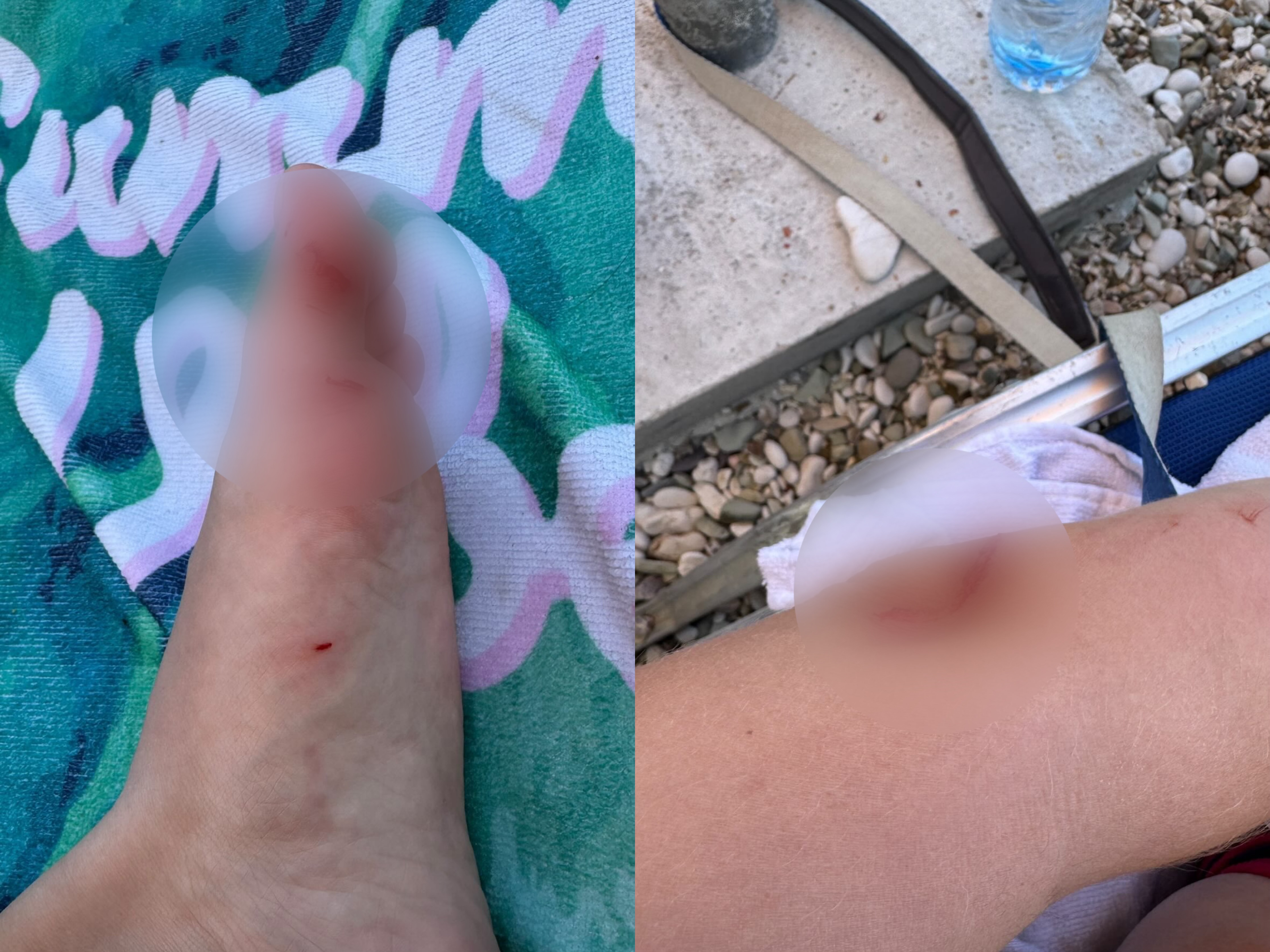 Motoskafi i rrezikon jetën turistes në Sarandë: I afrohet dhe e përplas drejt shkëmbinjve