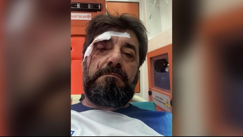 Analisti Ilir Demalia dhunohet nga dy persona në afërsi të shtëpisë