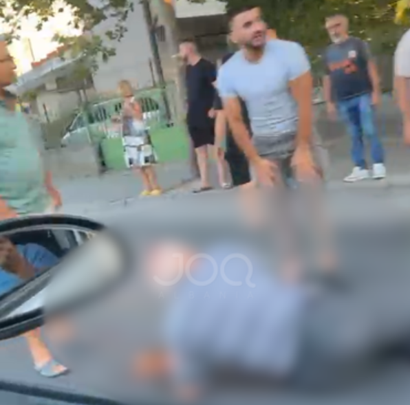 I moshuari përplaset nga makina  përfundon i gjakosur në mes të rrugës