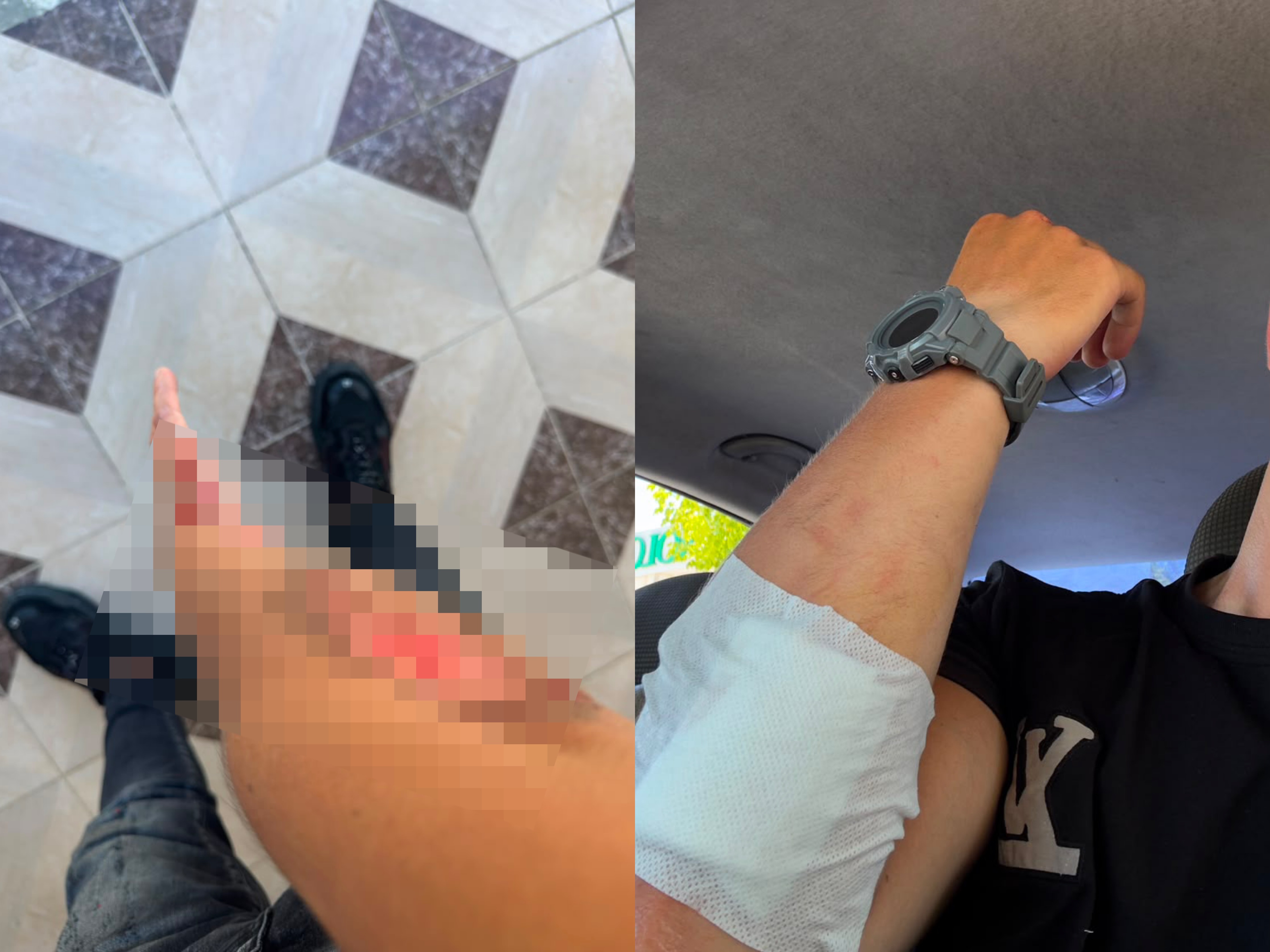 Vaji i derdhur në rrugë i rrezikon jetën motoristit  rrëzohet dhe bëhet copa