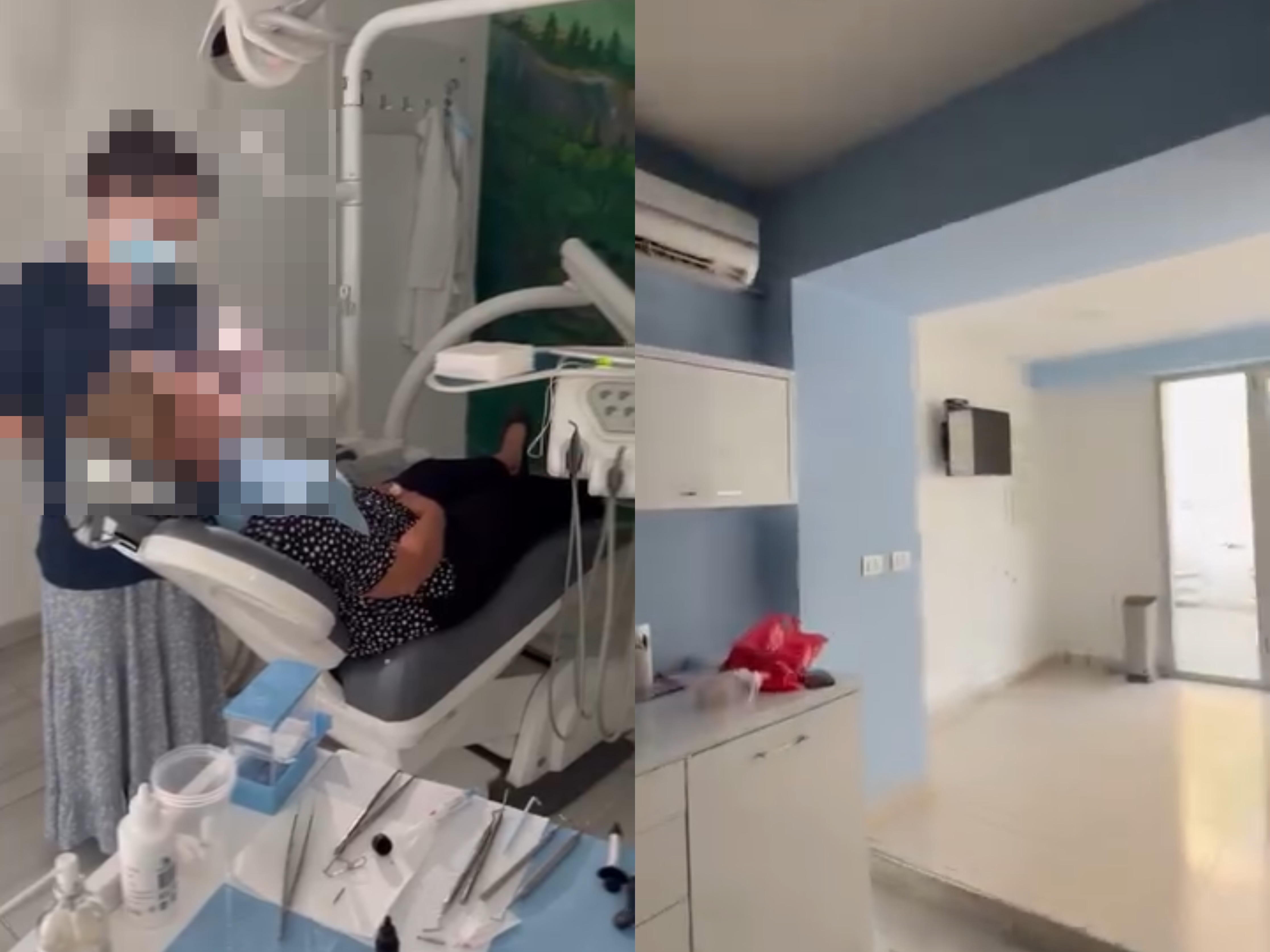 Ikin dritat në klinikën dentare  pacientja me gojën hapur prej disa orësh