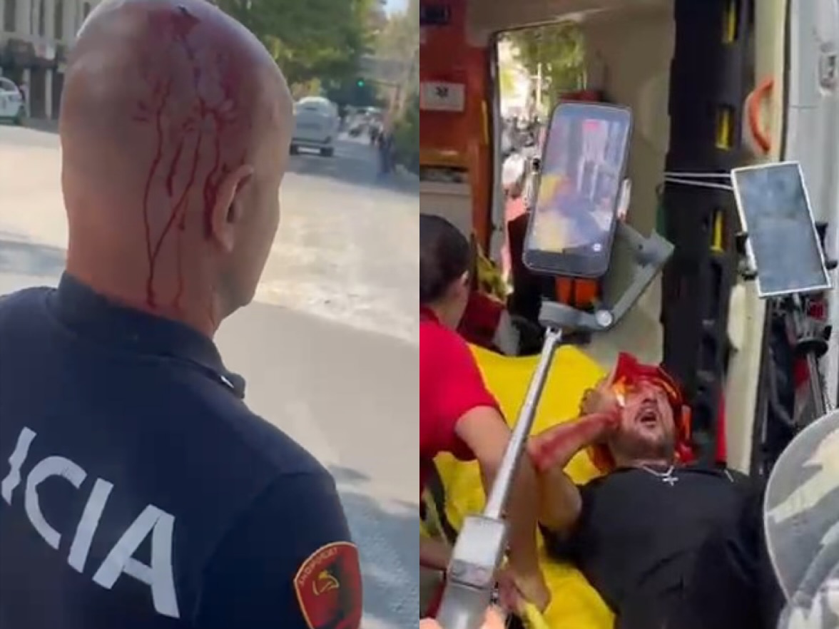 Gaz lotsjellës  ujë dhe sende të forta në protestë  2 protestues dhe 2 policë të lënduar