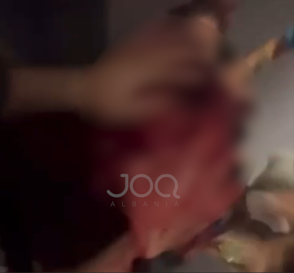 Personazhi i njohur i TikTok ut dhunohet brutalisht nga disa persona në Zvicër