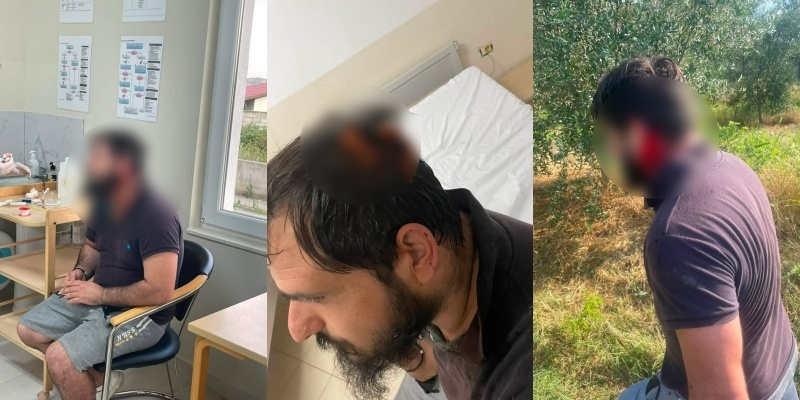 Familja nga Grykëshi i Madh: Fqinjët na rrahën në sy të policisë dhe po na marrin tokën