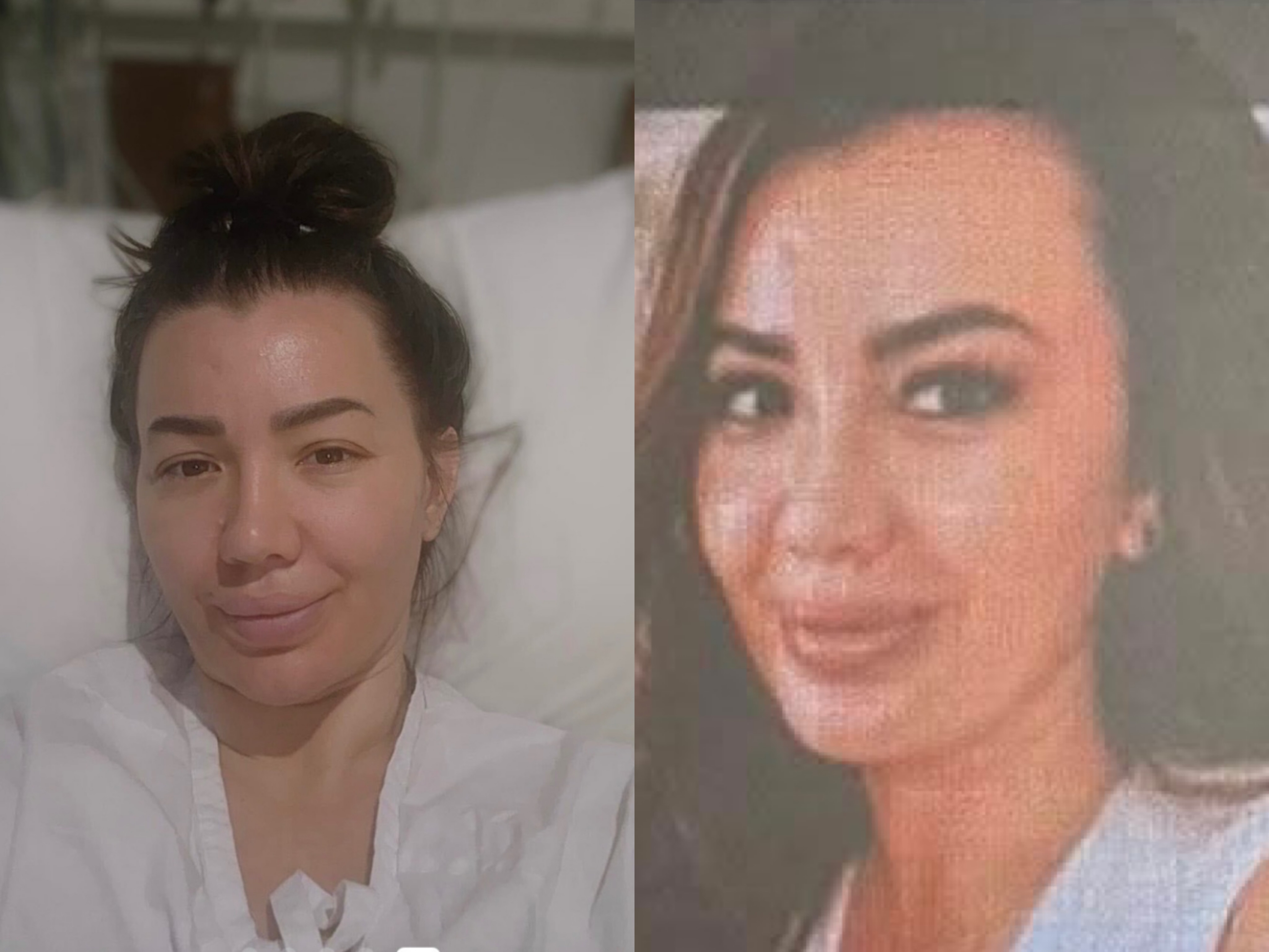 Shqiptarët u bënë bashkë për ta ndihmuar, Ariola ndahet nga jeta pas betejës së gjatë me kancerin