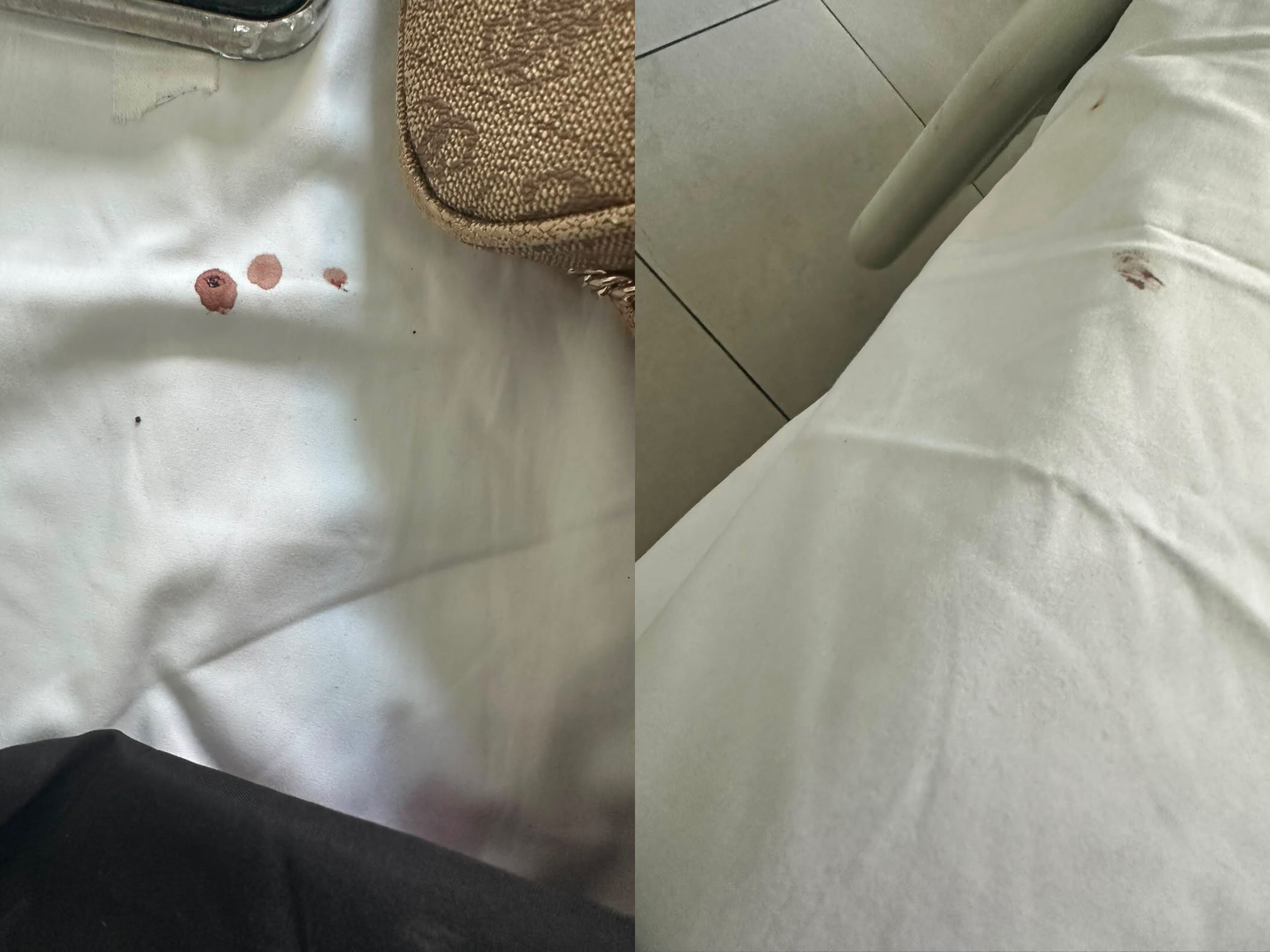 Denoncim nga spitali i Elbasanit: “Çarçafët nuk ndërrohen, pacientët lihen pa mbikëqyrje”