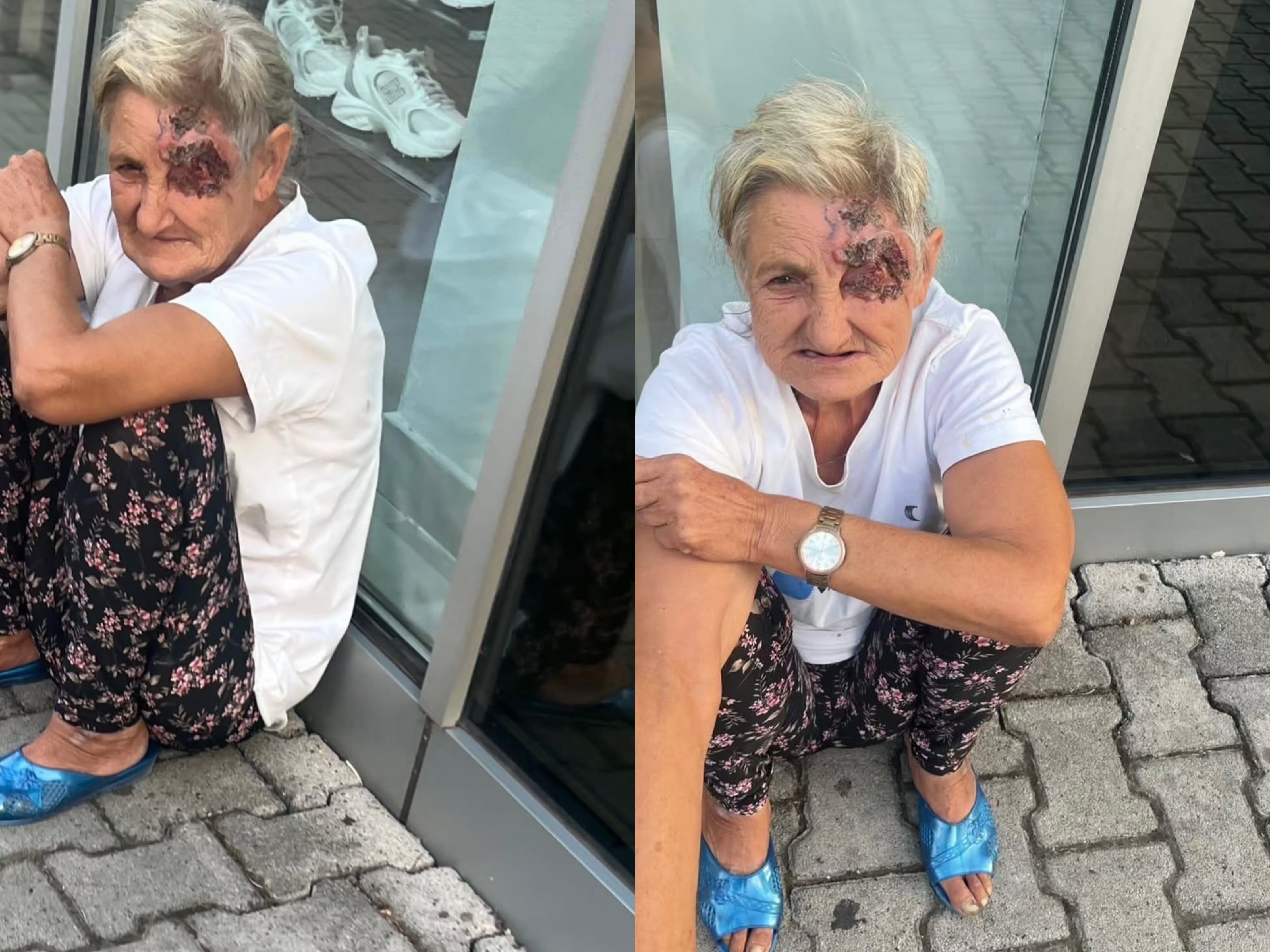  S kam para të kurohem   gruaja e sëmurë në Elbasan ka nevojë për ndihmë