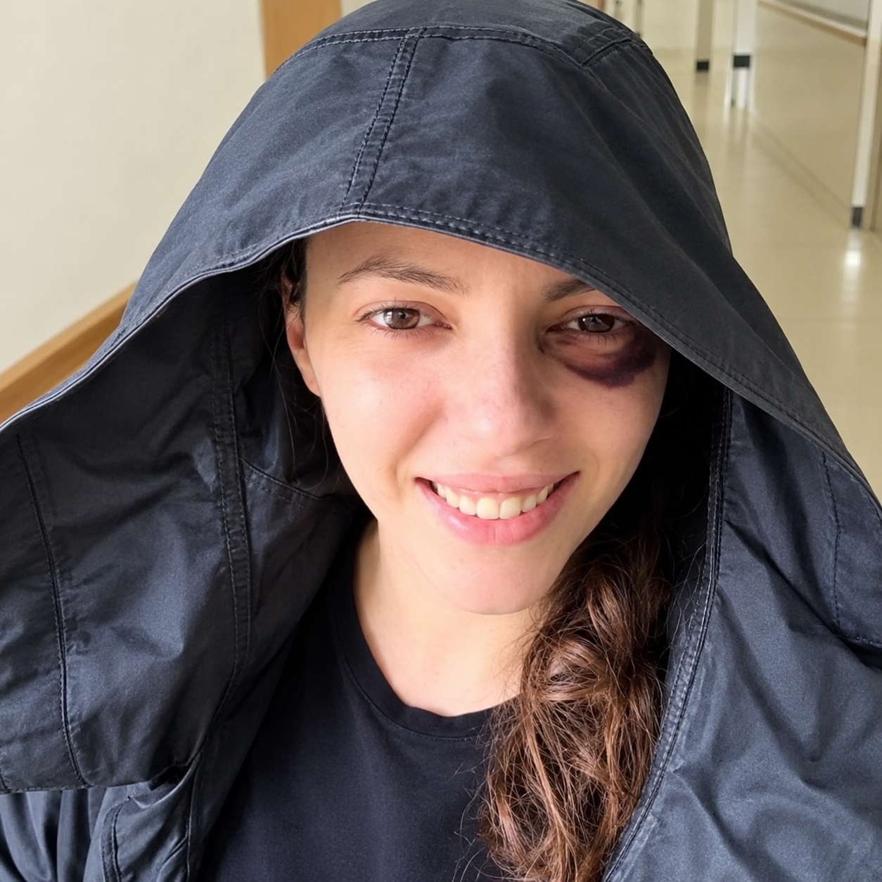 U plagos nga policia me predhë gazi lotsjellës, Eva Pango lë spitalin: Jam edhe më e motivuar