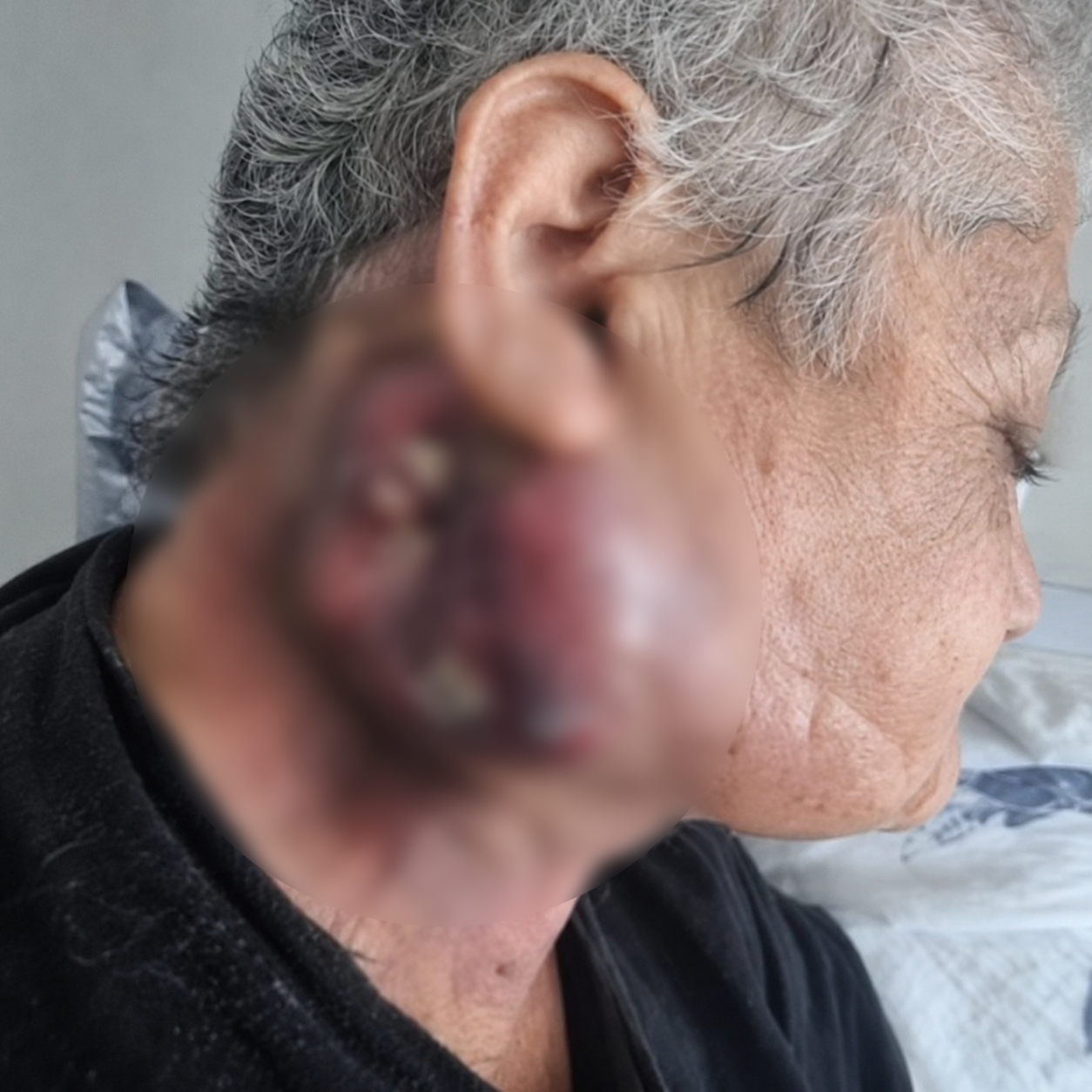 URGJENTE: Lindita prej 3 vitesh lufton me kancerin, ka nevojë të menjëhershme për gjak A+