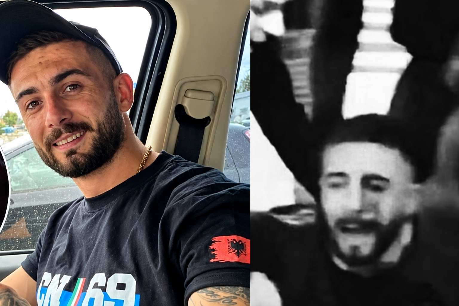 Policia e plagosi me plumb gome, protestuesi pëson hemorragji gjatë operacionit, shtyhet për sot ndërhyrja