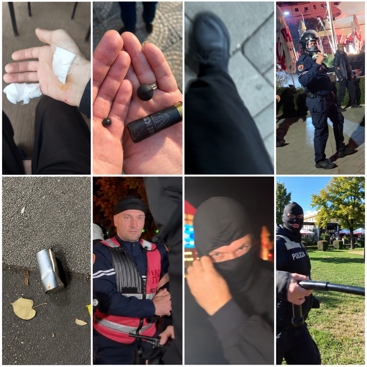 Katër gazetarë të TVA News të dhunuar gjatë protestave! Për çfarë i marrin fondet organizatat e medias?