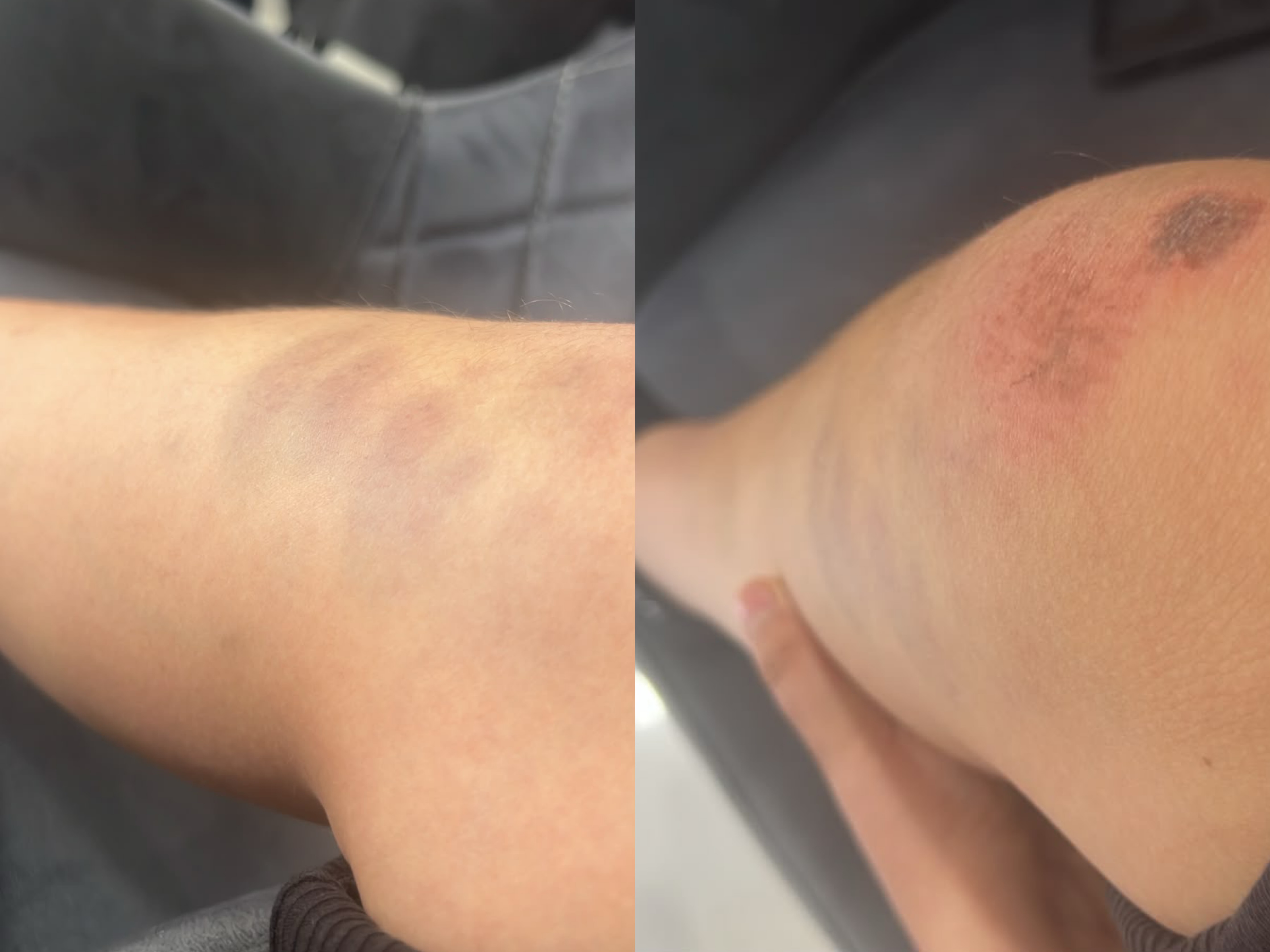 Po kthehej nga shkolla, 13-vjeçari: Policët më rrahën, më grisën librat dhe më shanë